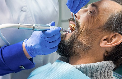 a man getting a dental cleaning