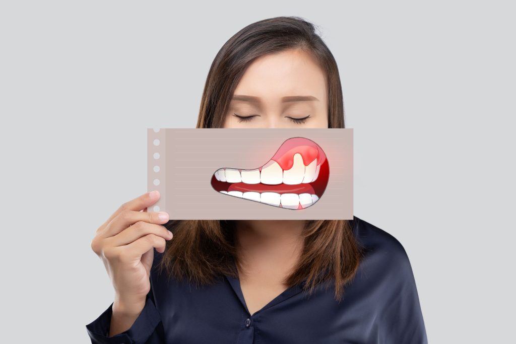 Woman in dark blue shirt with eyes closed holding image of swollen gums in front of mouth